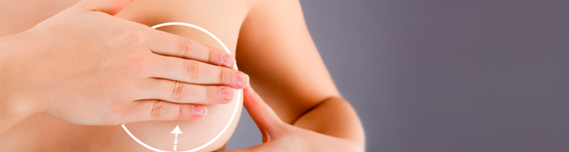 Потребуется ли мне подтяжка груди после удаления имплантатов?