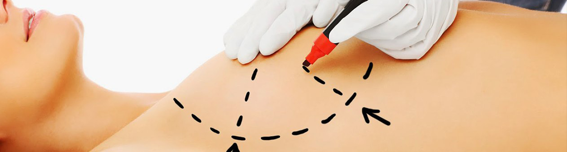 Подтяжка груди