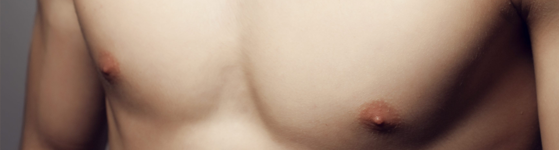 Что такое гинекомастия?