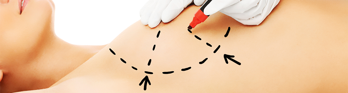 Каковы альтернативы процедуре?