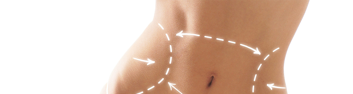 Как подготовиться к липэктомии?